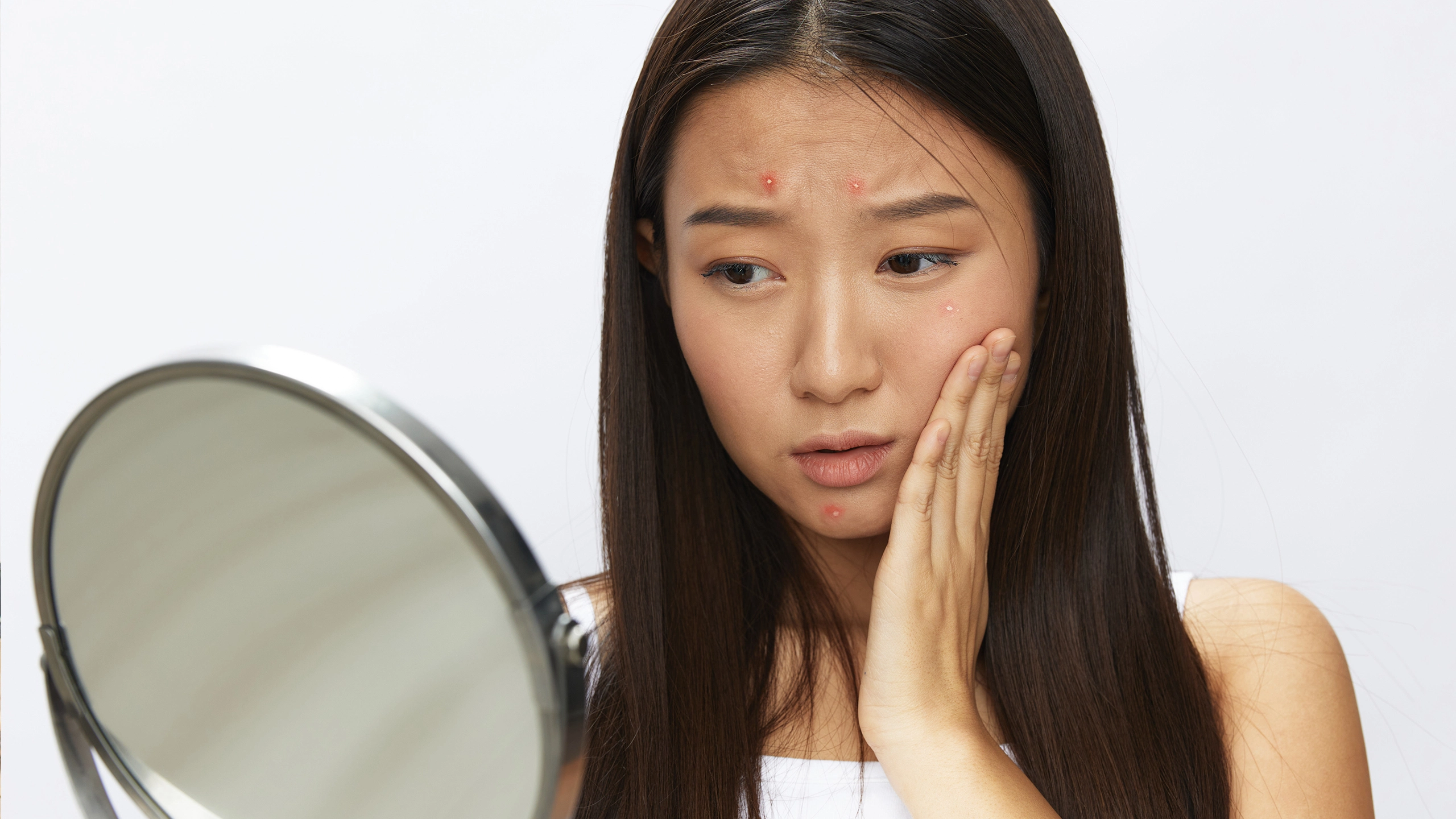 When Anxiety Shows Up on Your Skin: The Mind-Body Link Behind Stress Acne